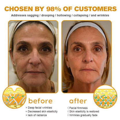 Made and dispatched in the UK✨ Pureluxo® Botox Bee Venom Wrinkle Removal Cream👨‍⚕️Recommended by dermatology experts🥑LAST DAY 80% OFF